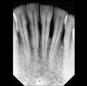 Incissor